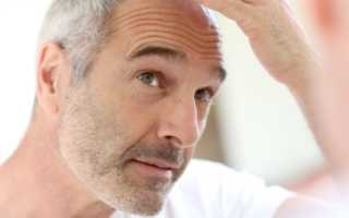 Если волосы выпадают клочьями, что делать и как решить проблему?