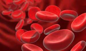 Как нормализовать гемоглобин у мужчин до 130 — 170