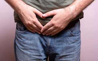 Причины прерывистого мочеиспускания у мужчин