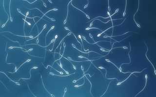 Что такое зооспермия?
