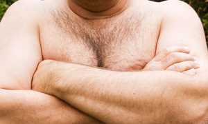 Причины мастопатии у мужчин