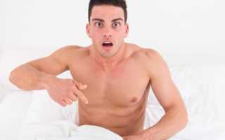 Почему возникают пигментные пятна на члене?