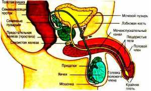 Почему возникают уплотнения в мошонке?