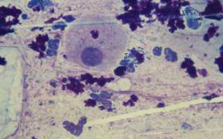 Гонококк как разновидность диплококков у мужчин