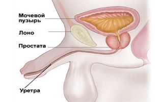 Правильное лечение уретрита у мужчин: препараты и схема