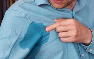 Лазеротерапия при повышенной потливости