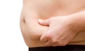 Особенности и лечение целлюлита у мужчин