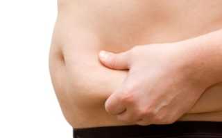 Особенности и лечение целлюлита у мужчин