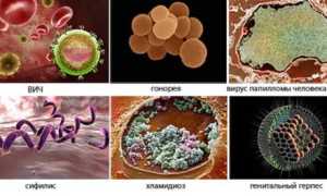 Почему возникает покраснение на члене?