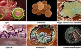 Почему возникает покраснение на члене?