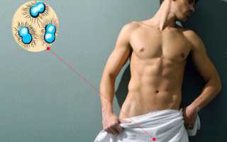 Как проявляется хроническая гонорея у мужчин