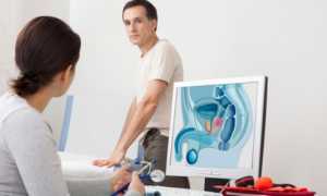 Чем эффективно лечить простатит?