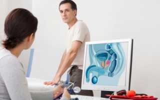 Чем эффективно лечить простатит?