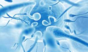 Причины и лечение тетразооспермии