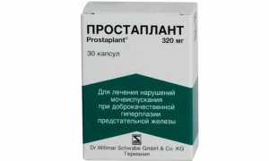 Современная терапия аденомы предстательной железы: отзывы о Простапланте