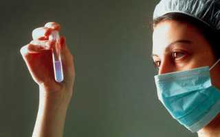 Полная информация об астенотератоспермии