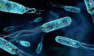 Причины нарушения микрофлоры у мужчин