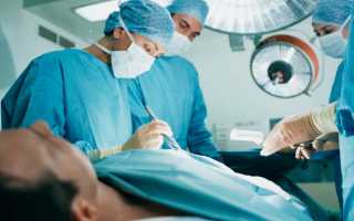 Простатит: нужна ли операция