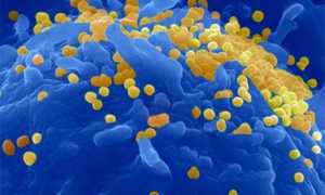 Воспаление полового члена и характеризующиеся им заболевания