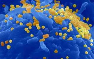 Воспаление полового члена и характеризующиеся им заболевания