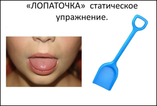 Артикуляционное упражнение "Лопаточка"