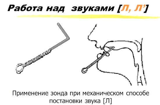 Механическая постановка звука л