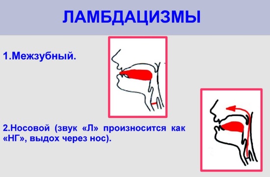 Ламбдацизмы