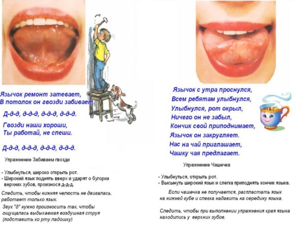 Артикуляционные упражнения "Забиваем гвозди", " Чашечка"