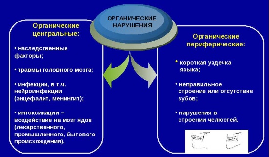 Органические причины нарушения речи