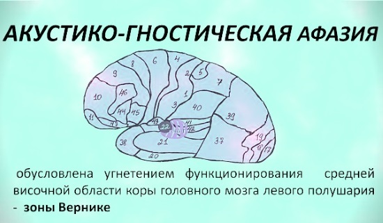 Область поражения мозга при акустико-гностической афазии