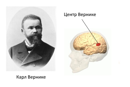 Центр Вернике