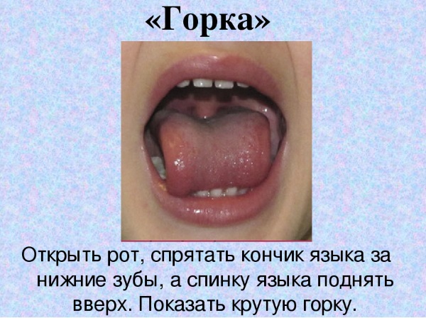 Артикуляционное упражнение "Горка"
