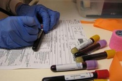 Анализ ПСА Анализ ПСА