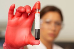 Анализ крови на резус-фактор Анализ крови на резус-фактор