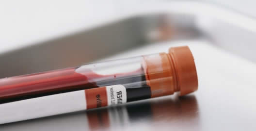 Анализ на лейкоциты Анализ на лейкоциты