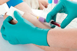 Анализ онкомаркера простаты Анализ онкомаркера простаты