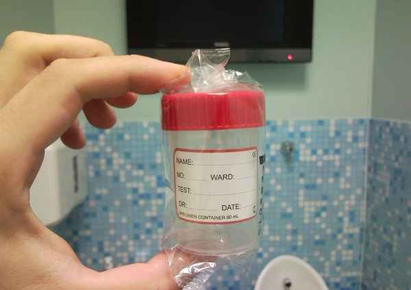 Анализ спермы Анализ спермы