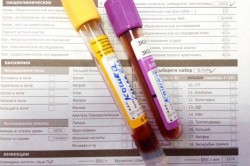 Анализы крови и мочи Анализы крови и мочи