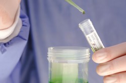 Анализы на микоплазму хоминис Анализы на микоплазму хоминис