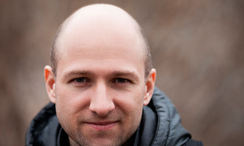 Андрогенная алопеция у мужчины Андрогенная алопеция у мужчины