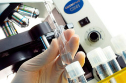 Астенотератозооспермия Астенотератозооспермия