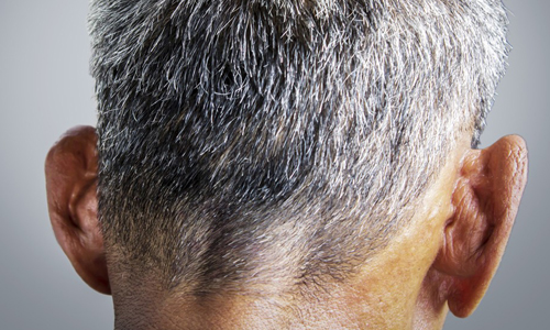 Борьба с седыми волосами Борьба с седыми волосами