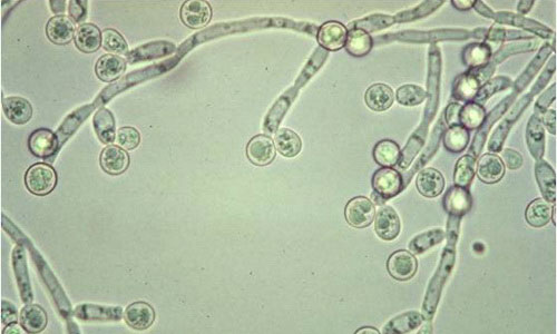 Грибок Candida Albicans Грибок Candida Albicans