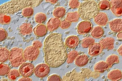 Хламидии Хламидии