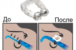 Действие магнитной клипсы Действие магнитной клипсы