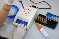 Диагностирование олиготератозооспермии Диагностирование олиготератозооспермии