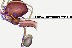 Доброкачественная гиперплазия Доброкачественная гиперплазия