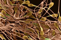 Движение сперматозоидов Движение сперматозоидов