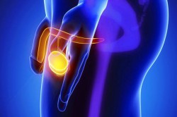 Хронический простатовезикулит Хронический простатовезикулит