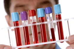 Иммуноферментный анализ Иммуноферментный анализ